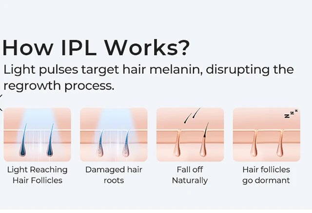 Nueva depiladora l&aacute;ser IPL permanente, m&aacute;quina para cortar cabello, alisadores, vibraci&oacute;n, afeitadora para hombre, depiladora l&aacute;ser para vello Facial femenino